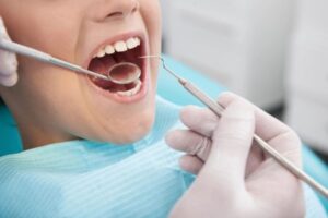 Dental whitening - Phoenix Comprehensive Dentistry